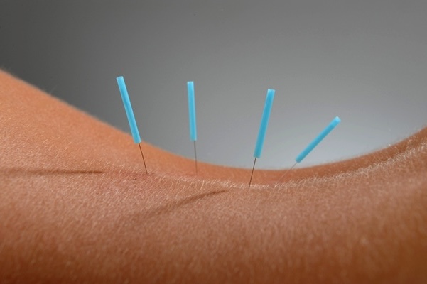  Naturheilpraxis Göttingen